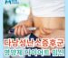 다낭성 난소 증후군 임신 자연 확률 다이어트 영양제 추천