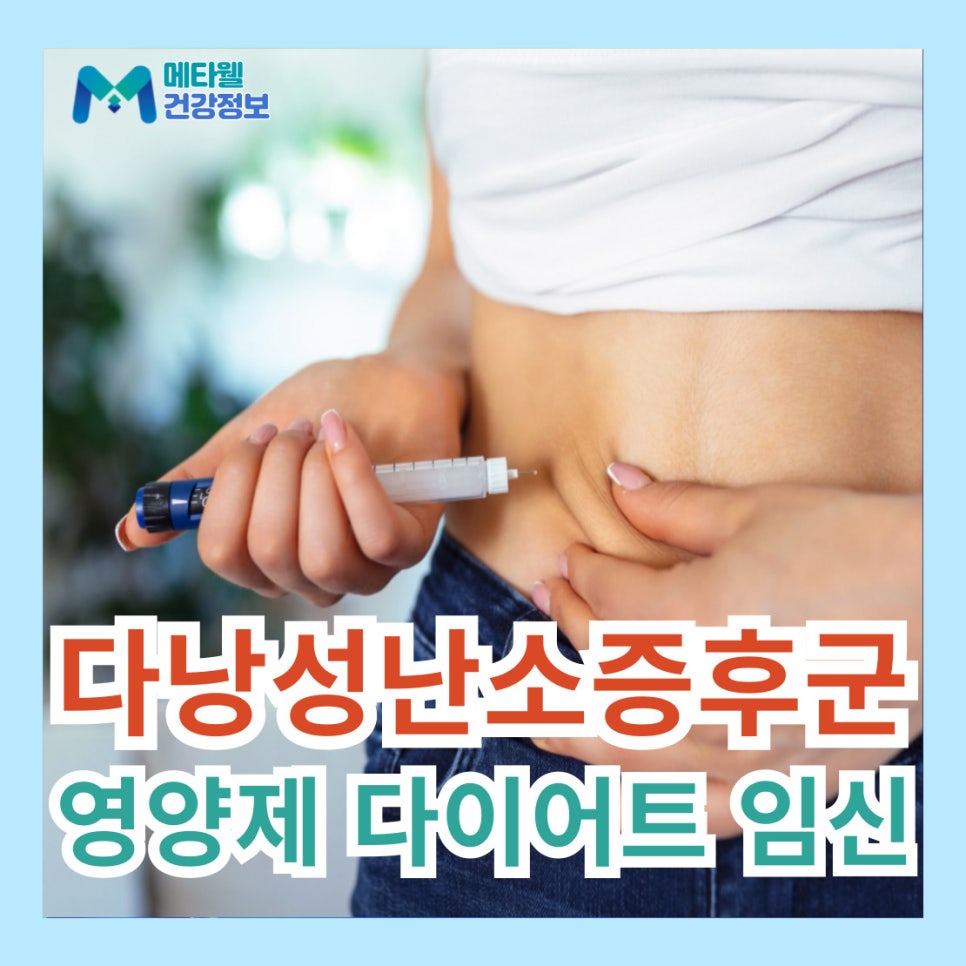 다낭성 난소 증후군 임신 자연 확률 다이어트 영양제 추천