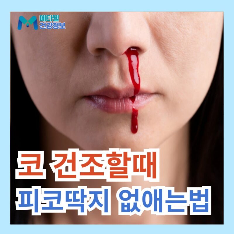 코에서 이상한 냄새 날 땐 피코딱지 때문일수도?