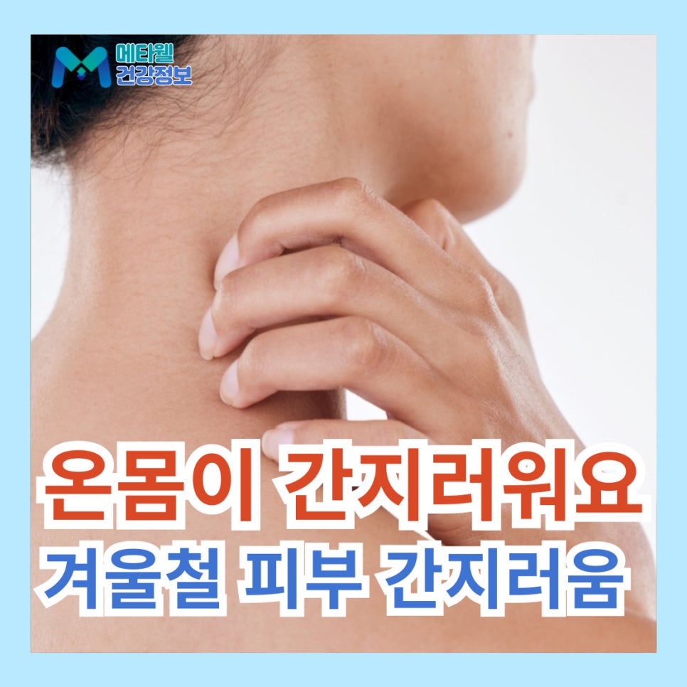 온몸이 간지러워요 겨울철 피부 간지러움 가려움증 원인 해결법