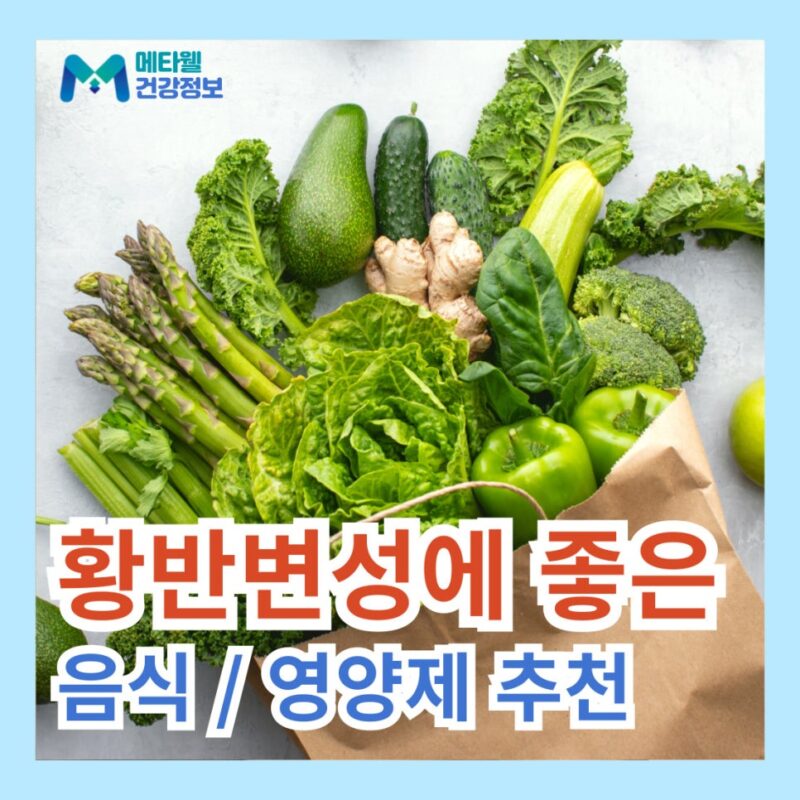 황반변성에 좋은 음식 눈 영양제 추천