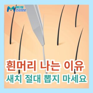 흰머리 원인 새치 나는 이유 뽑으면 안되는 이유 알아보기