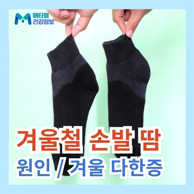 겨울철 손땀 발에 땀 많이 나는 이유 손발 겨울 다한증 관리 원인 증상 치료 방법