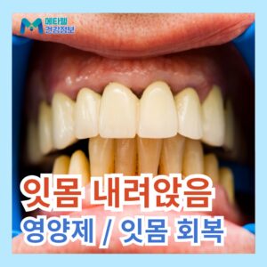 잇몸 올라감 퇴축 초기 먹어야 하는 잇몸에 좋은 영양제 추천