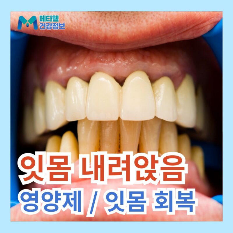 잇몸 올라감 퇴축 초기 먹어야 하는 잇몸에 좋은 영양제 추천