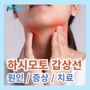 하시모토 갑상선염 증상 원인 치료 관리 방법 요오드 영양제 추천