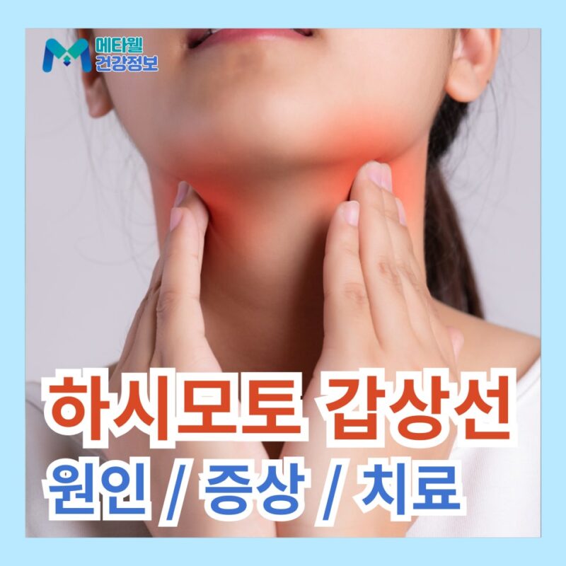 하시모토 갑상선염 증상 원인 치료 관리 방법 요오드 영양제 추천