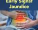 황달초기