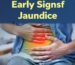 황달초기